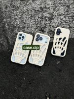 قاب آیفون طرح آناتومی اسکلت - تصویر 4